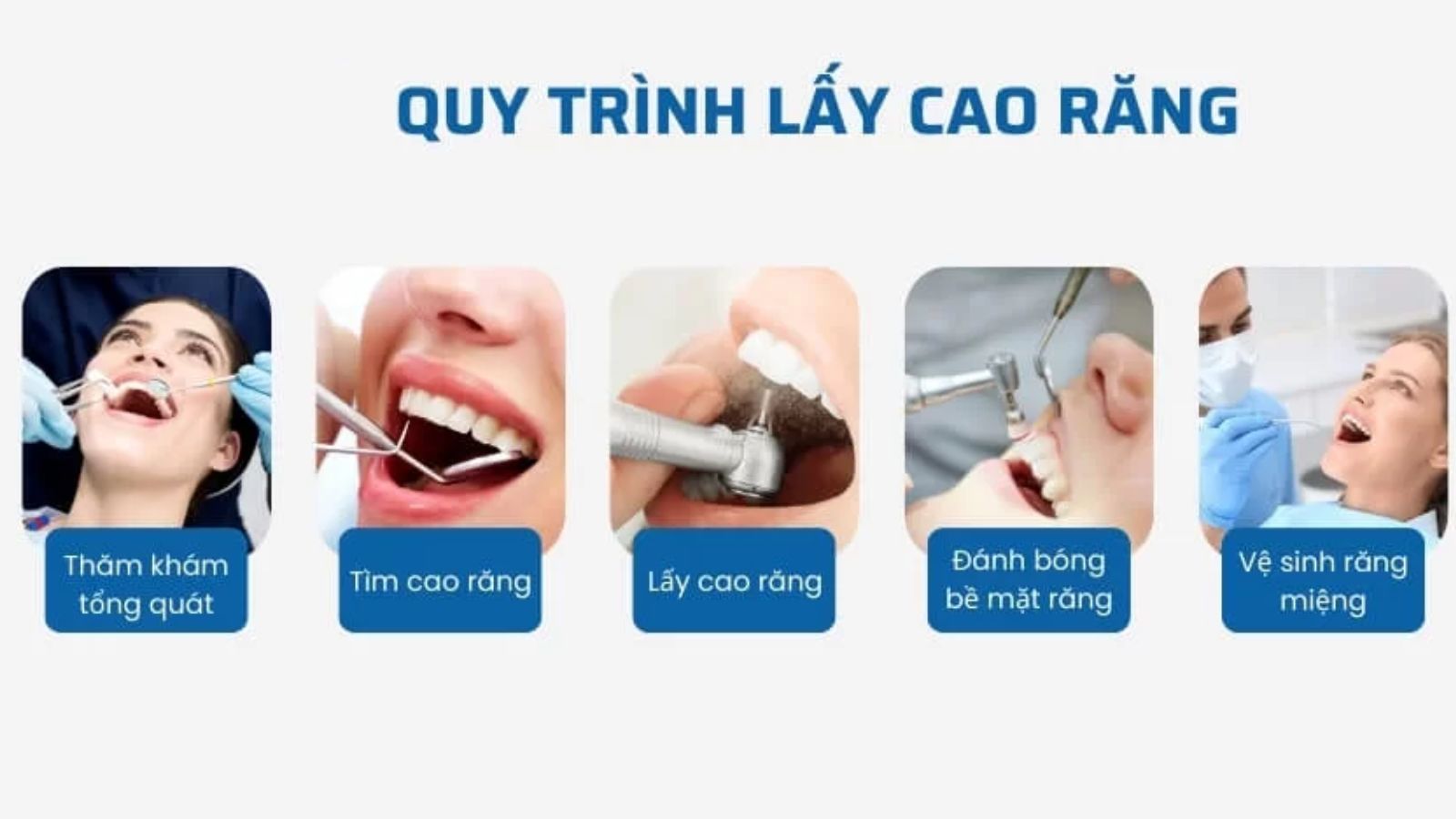 Quy trình lấy vôi, đánh bóng răng tiêu chuẩn nha khoa.